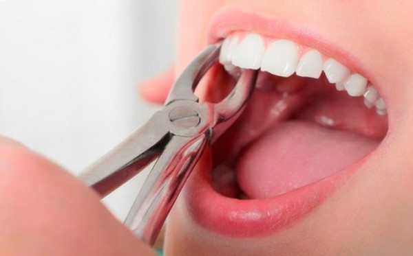 Хирургическая стоматология. Современные методы лечения зубов